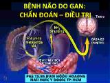 Bài giảng Bệnh não do gan: Chẩn đoán, điều trị