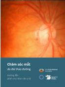 Bài giảng Chăm sóc mắt do đái tháo đường