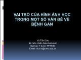 Bài giảng Vai trò của hình ảnh học trong một số vấn đề về bệnh gan
