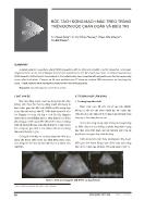 Bóc tách động mạch mạc treo tràng trên đơn độc chẩn đoán và điều trị