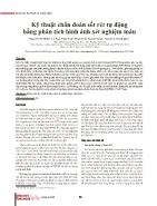 Kỹ thuật chẩn đoán sốt rét tự động bằng phân tích hình ảnh xét nghiệm máu