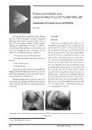 Phân loại pi-Rads của cộng hưởng từ (CHT) tuyến tiền liệt