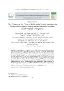 Tìm hiểu đặc điểm đa giác Willis trên phim chụp cắt lớp vi tính đa dãy ở bệnh nhân phình động mạch não